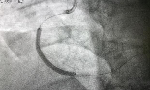 Dr Elly Redwood and Professor David Brieger