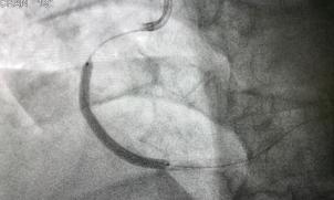 Dr Elly Redwood and Professor David Brieger